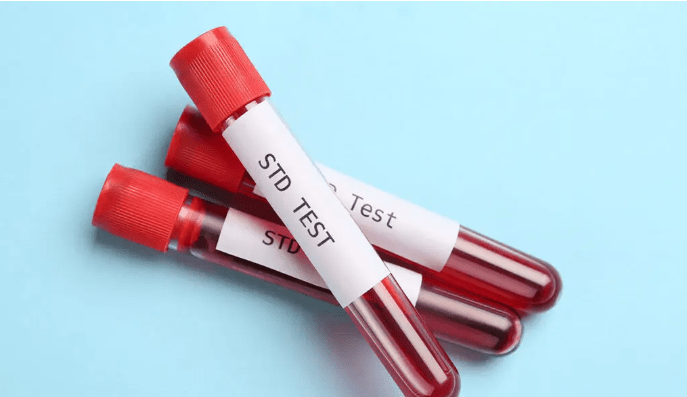 Understanding Common STDs: Symptoms, Causes, and Treatments