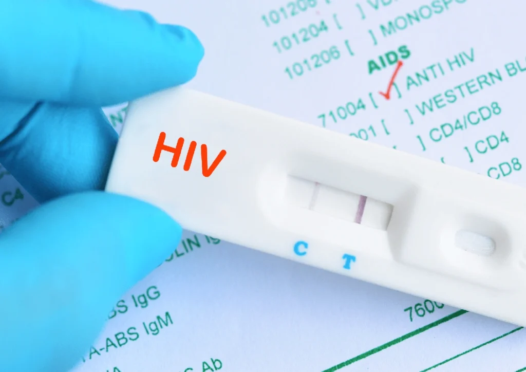Hand wearing blue glove holding a rapid HIV test device showing a negative result with medical report background.